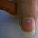 دلایل ایجاد لکه های سفید روی ناخن ها لکه های سفید روی ناخن چه معنایی دارد؟